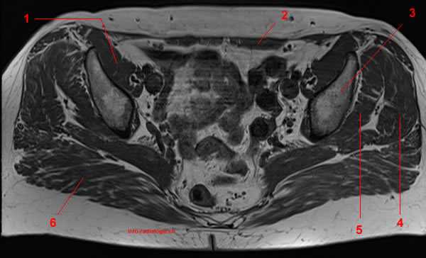 MRI of the Hip: Detailed Anatomy