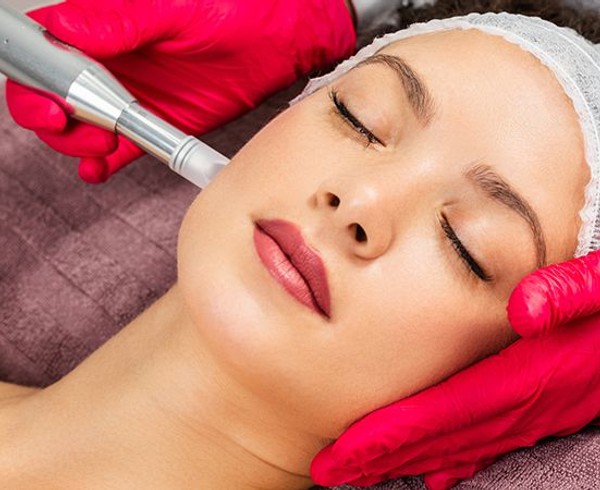 how much does microneedling cost in toronto
