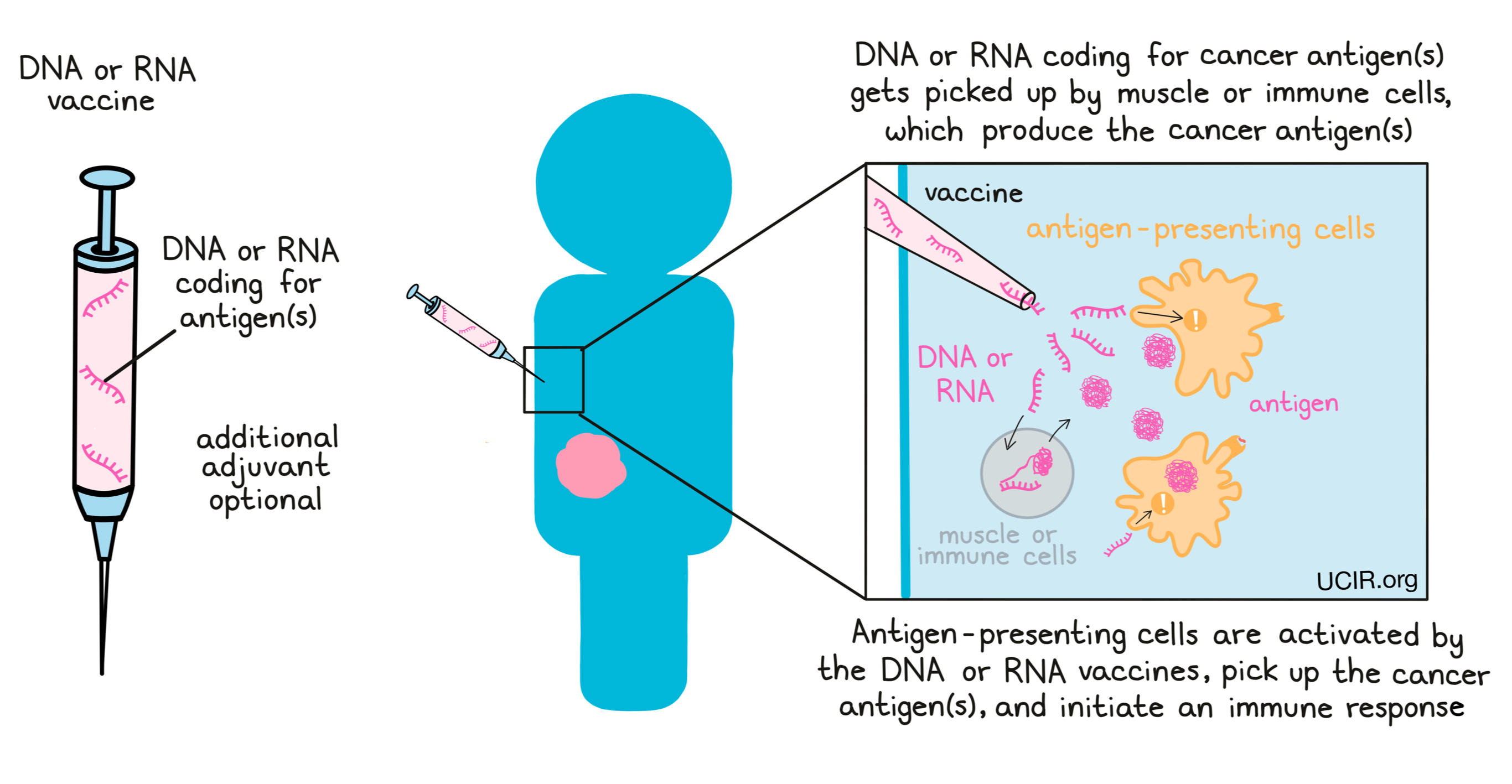Some vaccines are made using DNA or RNA, which code for the cancer antigens