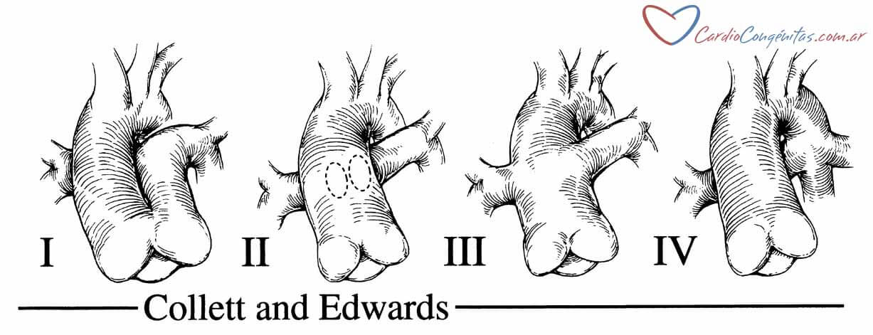 Collett-y-Edwards