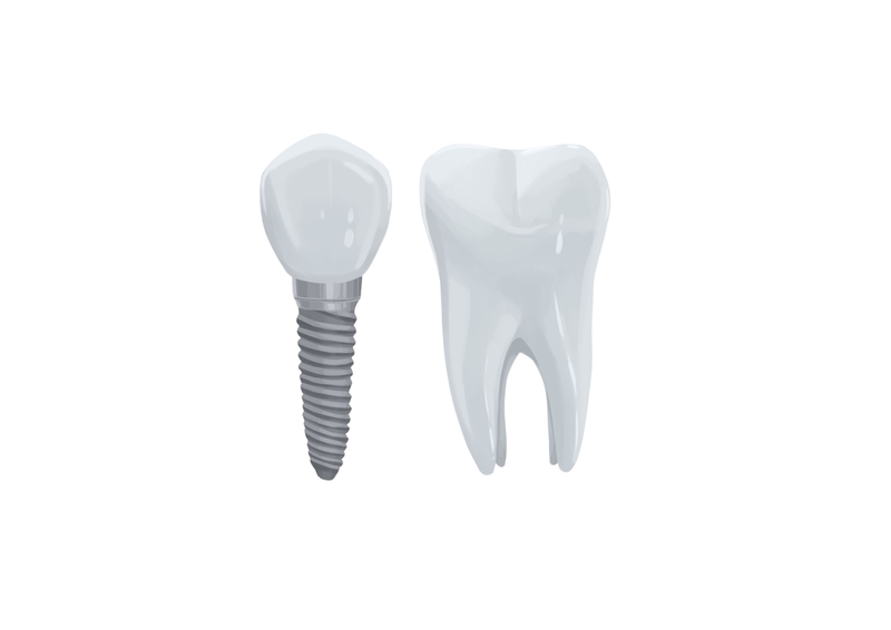 Tooth implant next to molar tooth