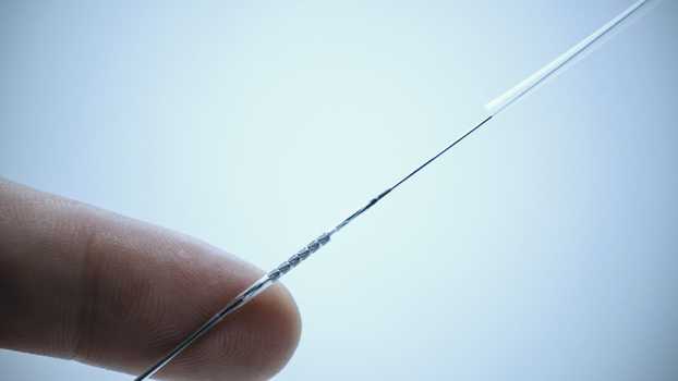 Cum se montează un stent - Centrele ARES | Lider in Cardiologie