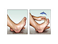 "Plantar