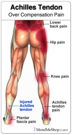 "Plantar