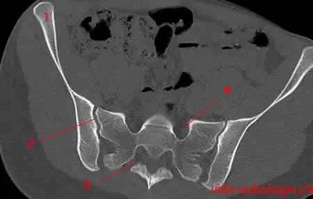 Sacrum And Coccyx Anatomy
