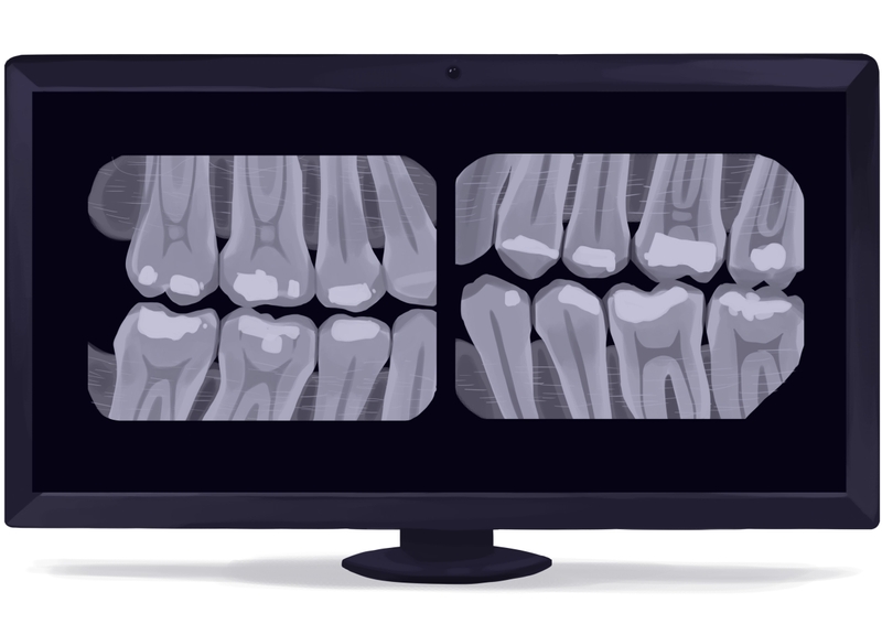 What is the average cost of a dental crown in 2022? | Authority Dental