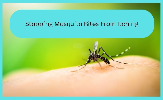 How to Stop Mosquito Bites from Itching: 13 Effective Methods