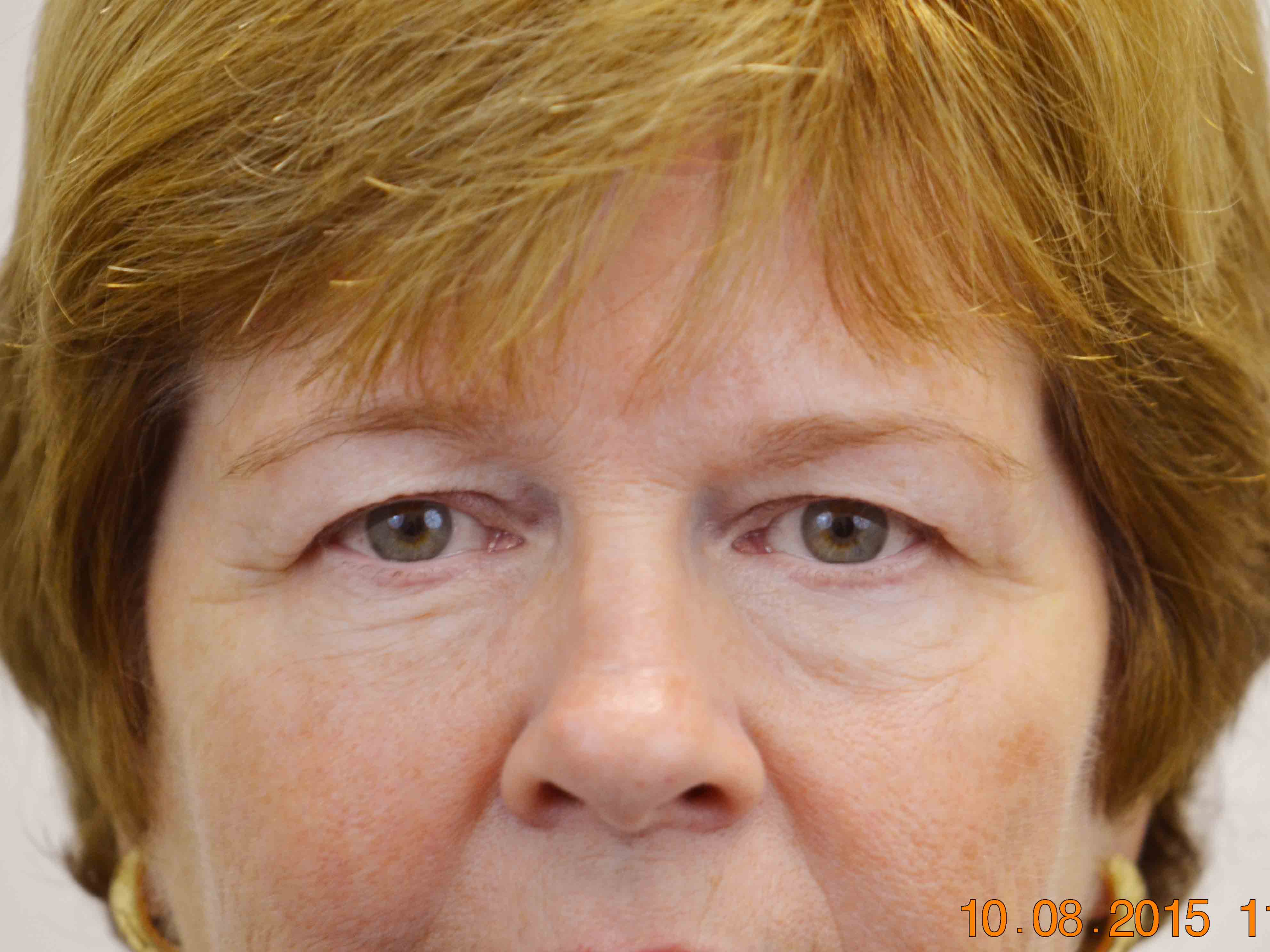 16984-before.jpg