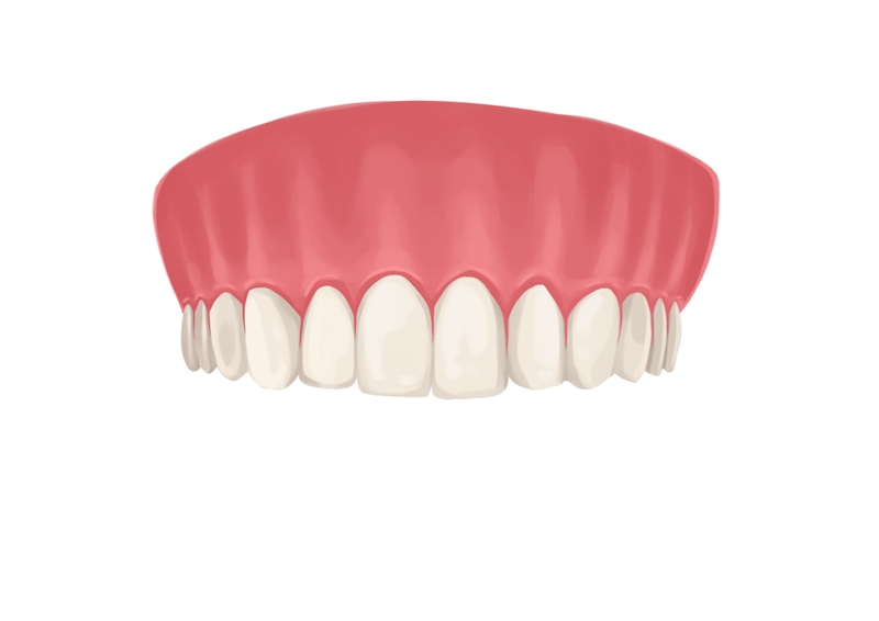 Upper teeth arch