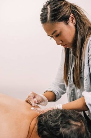 Gunn Intramuscular Stimulation (IMS)