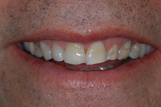 Before