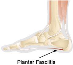 "Plantar