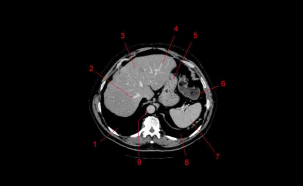 Atlas of CT Anatomy of the Abdomen