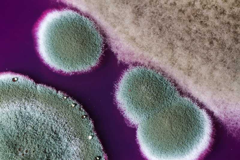 mold on a petri dish