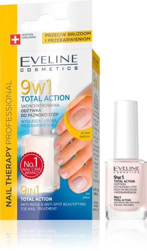 EVELINE NAIL THERAPY 9IN1 TOTAL ACTION lábköröm ápoló 12 ml