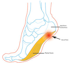 "Plantar