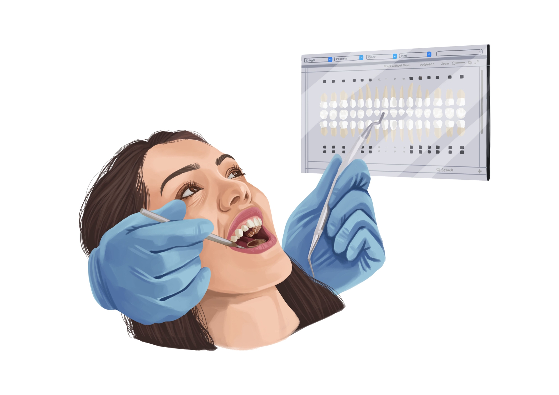 Palate expander types, uses, and side effects Authority Dental