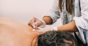 Gunn Intramuscular Stimulation (IMS)