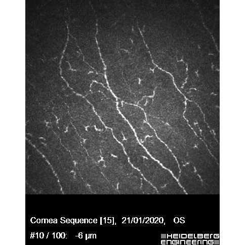 Corneal confocal microscopy image