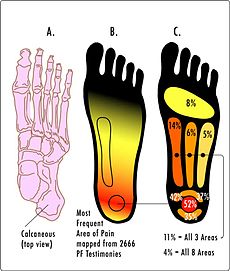 "Plantar