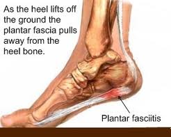 "Plantar