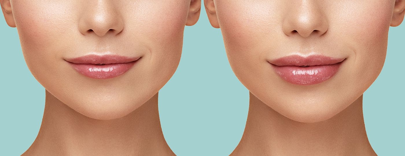 botox treatments in thornhill before after