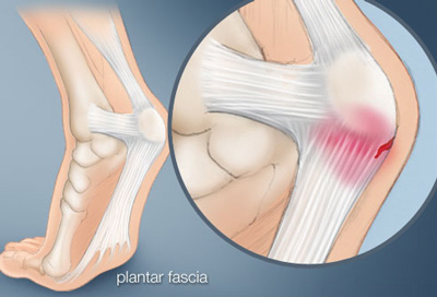 "Plantar