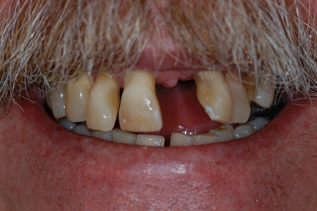 Before