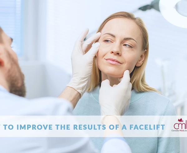 results of a facelift