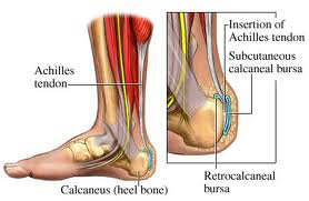 "Plantar