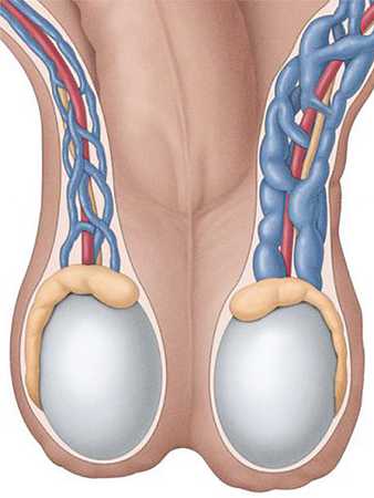 Varicocelul - cauze, simptome, tratament