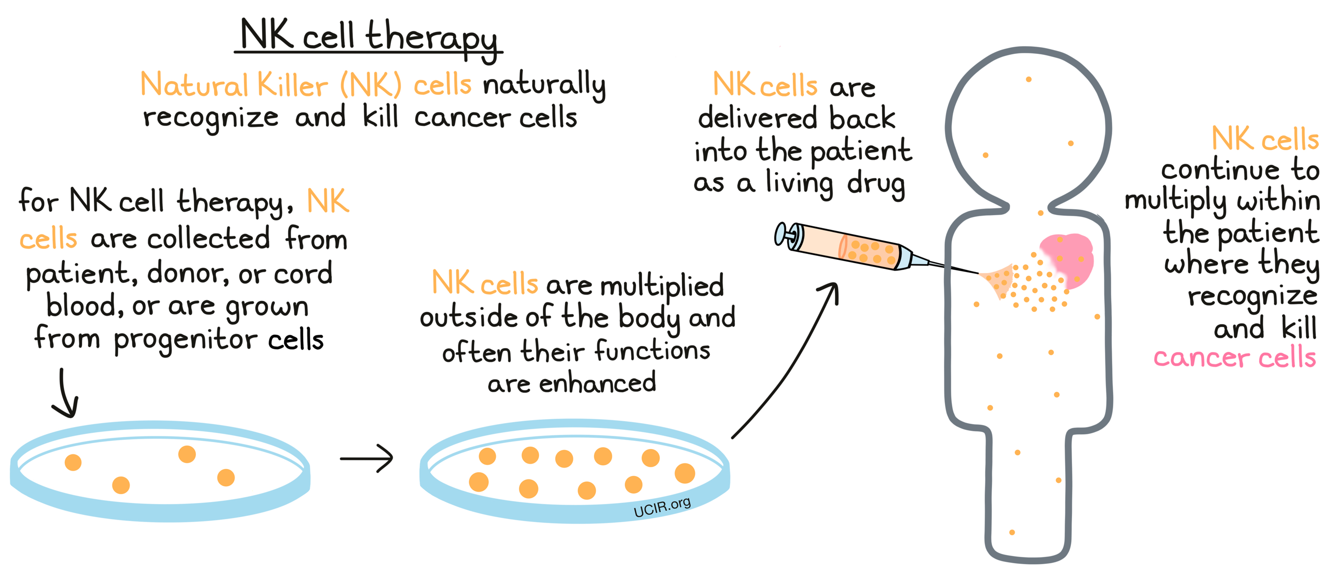 Illustration showing how NK cell therapy works