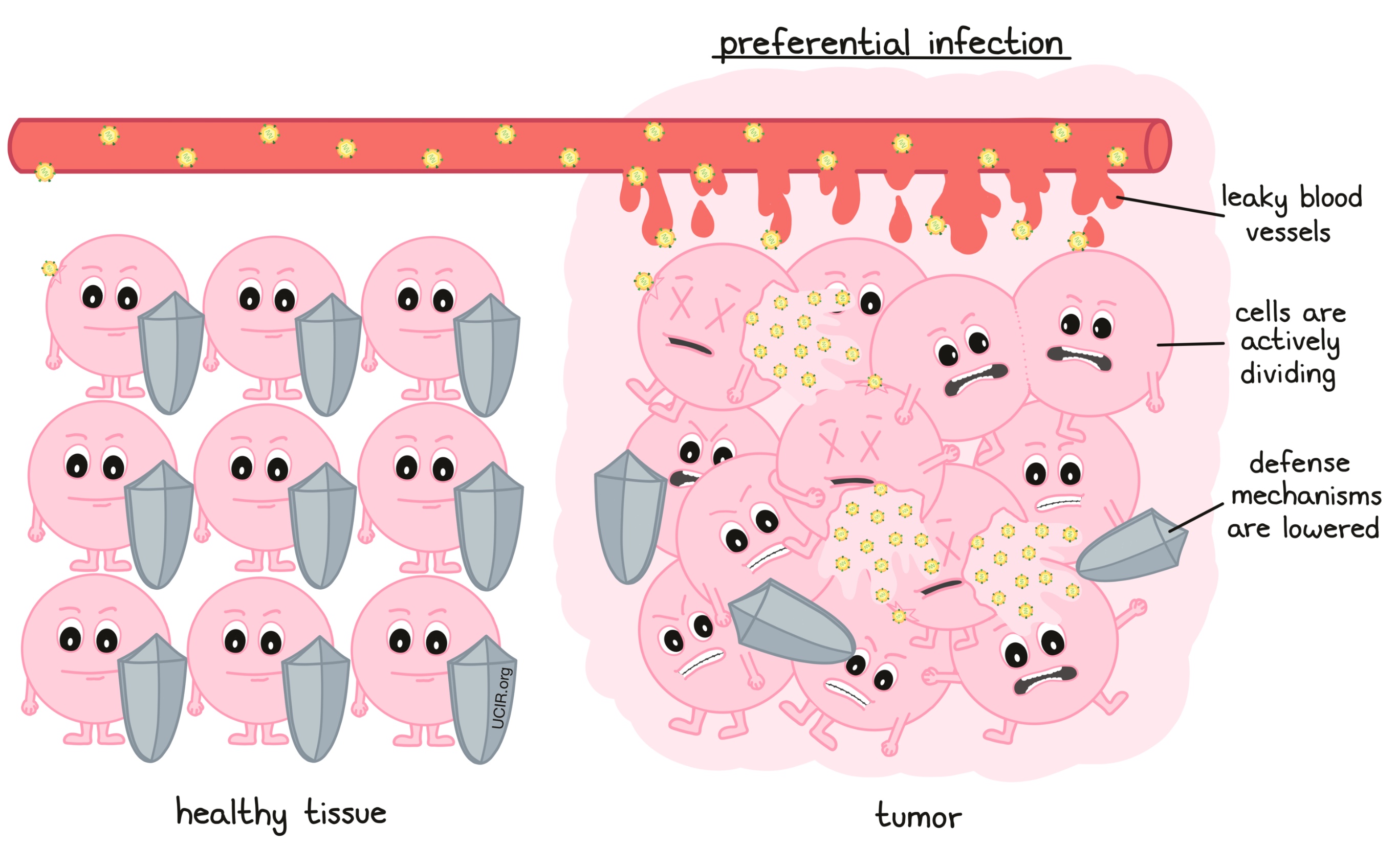 Preferential infection image