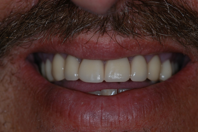 After