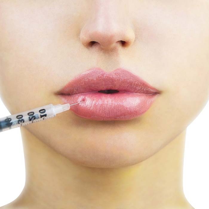 Gen Z And Millenials – Major Lip Injections Enthusiasts