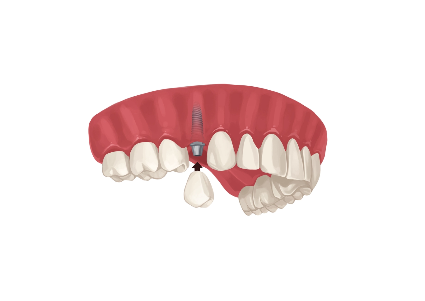 Picture by Authority Dental under CC 2.0 license