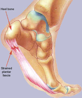 "Plantar