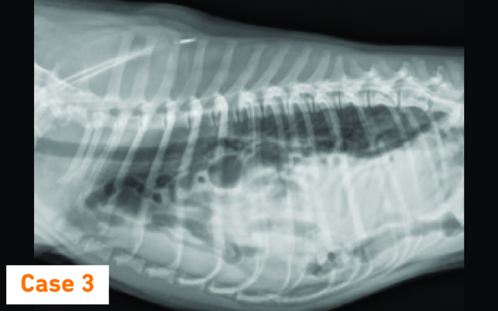 Hernia case study radiographic image