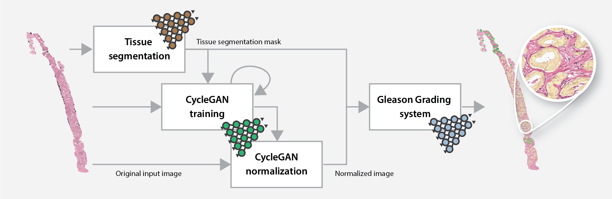 Overview of the online Gleason grading algorithm, including the normalization step.