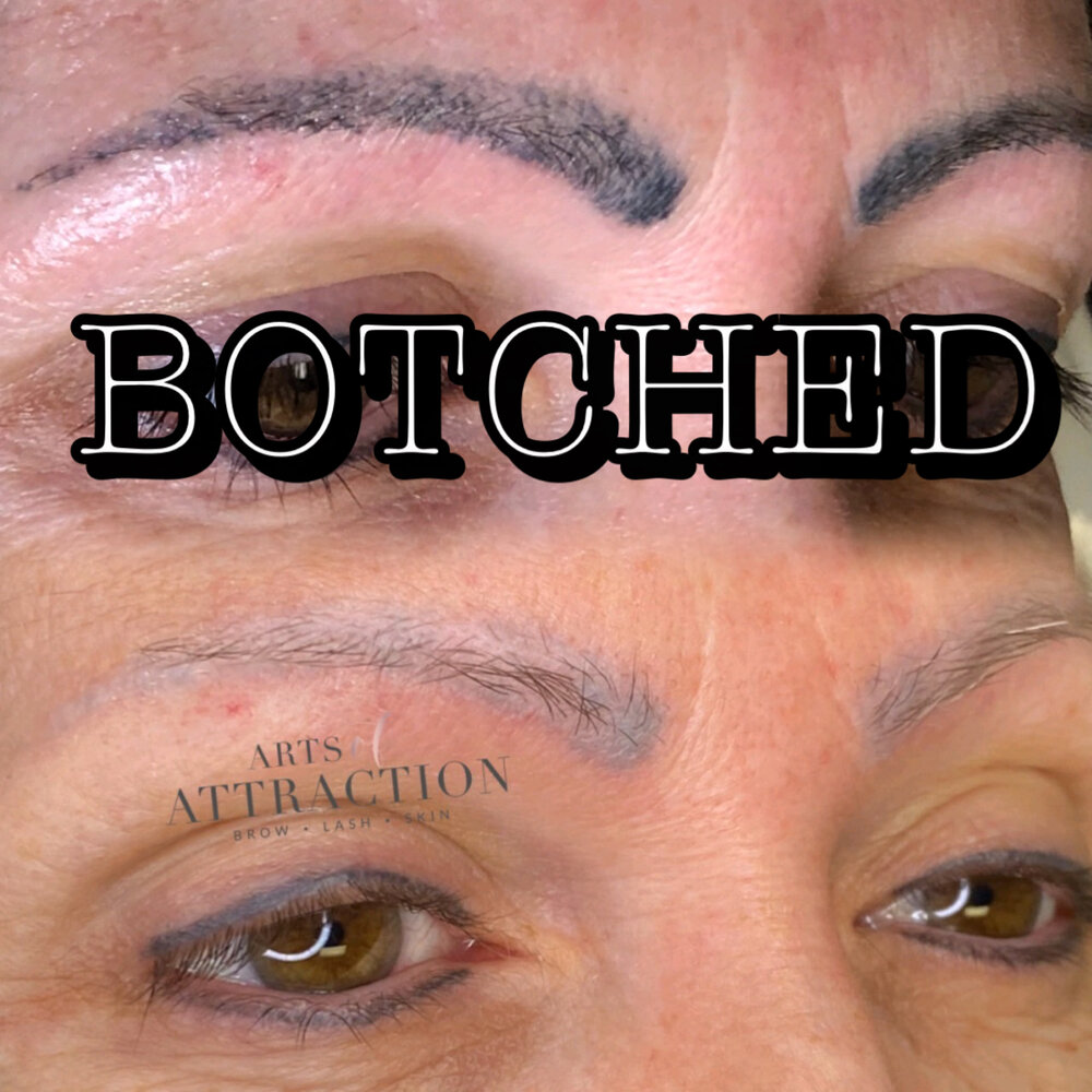 Tattoo/Permanent Makeup Removal - 24 Hour Critical Period!