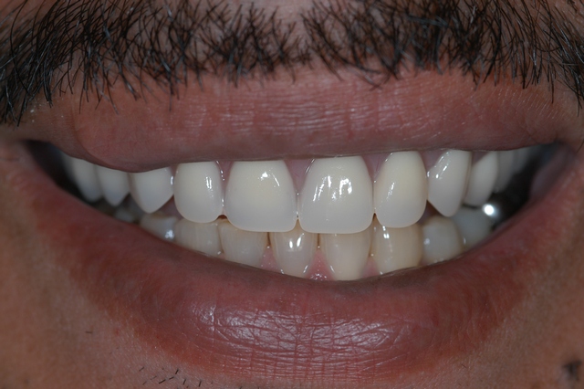After