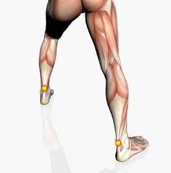 "Plantar