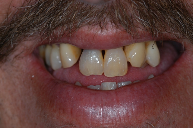Before