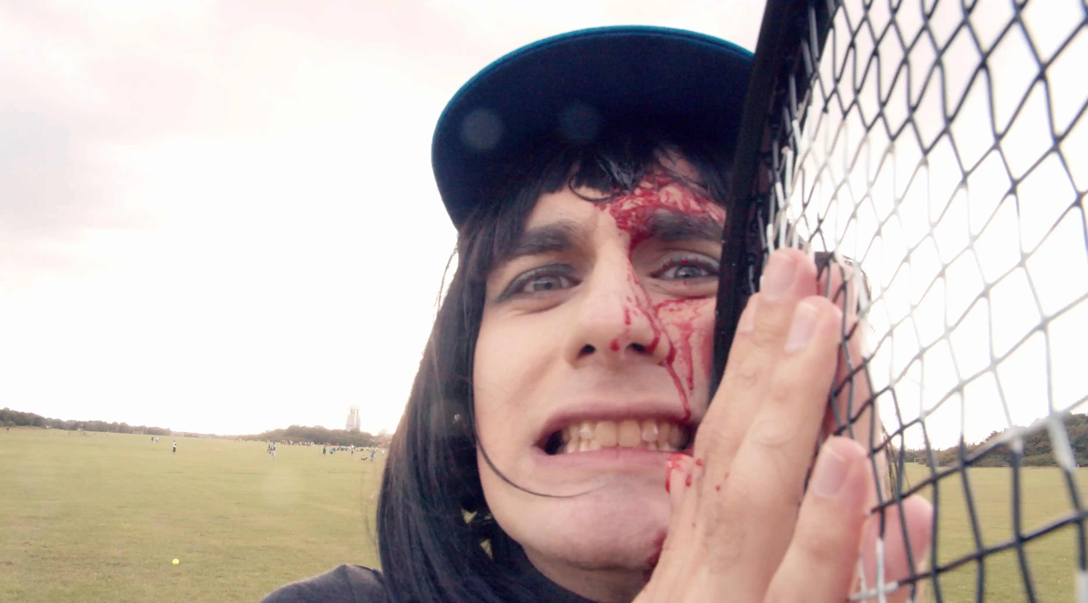 WA with a tennis racket lodged in their bloody face, THIS IS SPORT