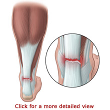 "Plantar