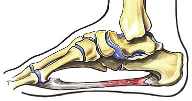 "Plantar