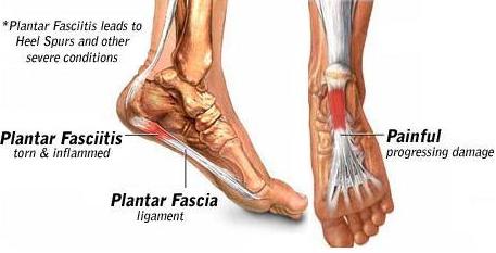 "Plantar