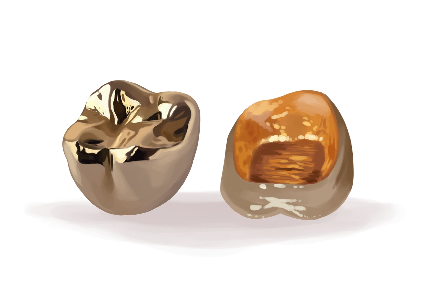 What is a dental crown? Types and procedure Authority Dental