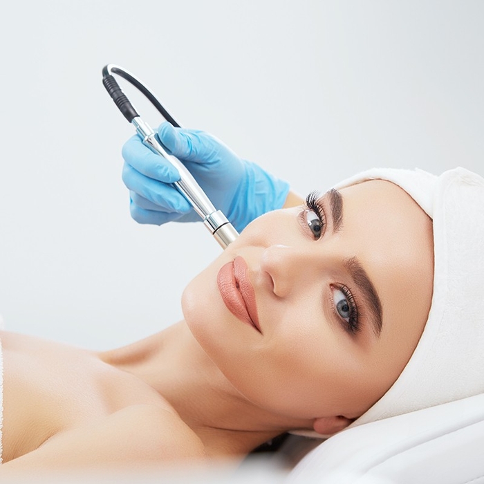 Microdermabrasion for Acne and Scarring