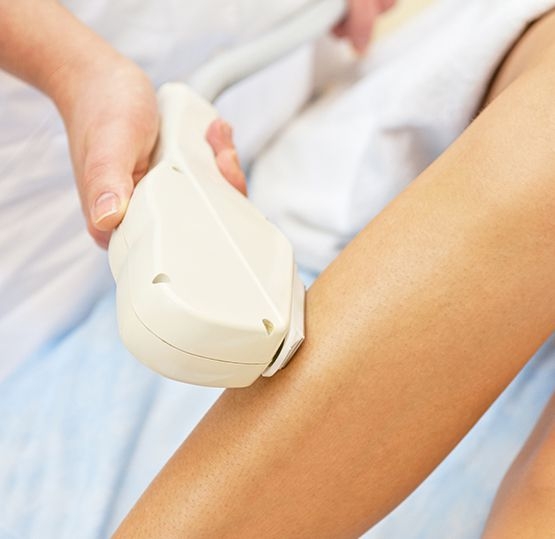 thornhill-laser-hair-removal